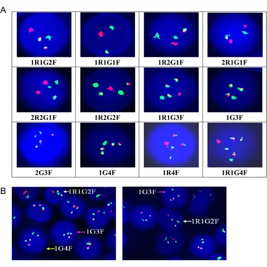 bcr abl gene rearrangement, pcr, quantitative test